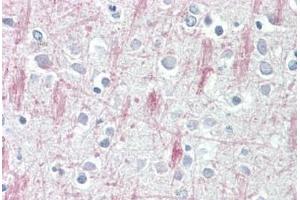 Human Brain, Cortex: Formalin-Fixed, Paraffin-Embedded (FFPE)