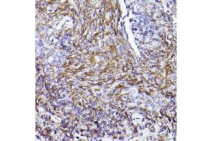 Immunohistochemistry of paraffin-embedded human placenta using [KO Validated] CD73/NT5E Rabbit pAb (ABIN3022733, ABIN3022734, ABIN3022735, ABIN1513283 and ABIN6219201) at dilution of 1:50 (40x lens).