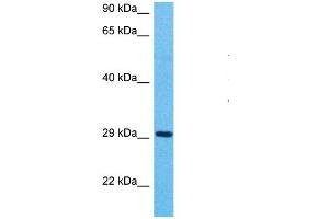 Host:  Rabbit  Target Name:  MFF  Sample Type:  Stomach Tumor lysates  Antibody Dilution:  1. (MFF anticorps  (C-Term))