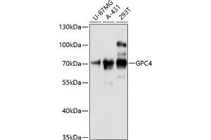 Western blot analysis of extracts of various cell lines, using GPC4 antibody (ABIN6127961, ABIN6141311, ABIN6141312 and ABIN6216562) at 1:3000 dilution. (GPC4 anticorps  (AA 357-556))
