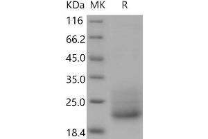 Western Blotting (WB) image for CD7 (CD7) (Active) protein (His tag) (ABIN7320293) (CD7 Protein (CD7) (His tag))