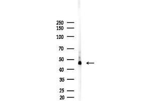 anti-Aldehyde Dehydrogenase 5 Family, Member A1 (ALDH5A1) (Internal Region) antibody