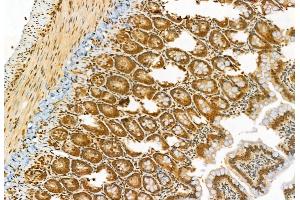 ABIN6265767 and ABIN6278388 at 1/100 staining Rat colon tissue by IHC-P.