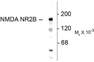 Western blots of 10 ug of rat hippocampal lysate showing specific immunolabeling of the ~180k NR2B subunit of the NMDA receptor. (GRIN2B anticorps  (N-Term))