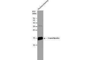 WB Image Human tissue extract (30 μg) was separated by 15% SDS-PAGE, and the membrane was blotted with Transthyretin antibody [N1C3] , diluted at 1:500. (TTR anticorps)