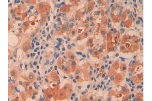 Detection of CTH in Human Stomach Tissue using Polyclonal Antibody to Cystathionine (CTH)