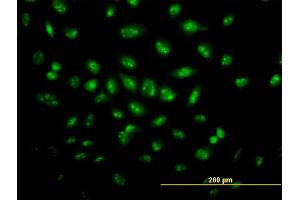 Immunofluorescence of monoclonal antibody to TP53RK on HeLa cell. (TP53RK anticorps  (AA 154-253))