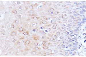 Immunohistochemistry of paraffin-embedded Human esophageal using Polyclonal AntibodyPC1 Polyclonal Antibody at dilution of 1:100 (40x lens). (PC1 anticorps)