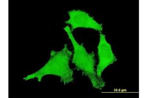 Immunofluorescence of monoclonal antibody to ANKRD17 on HeLa cell.