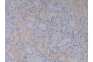DAB staining on IHC-P; Samples: Human Kidney Tissue. (BMP10 anticorps  (AA 315-424))