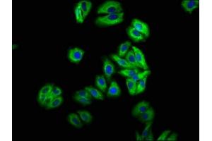 Immunofluorescence staining of HepG2 cells with ABIN7157984 at 1:66, counter-stained with DAPI. (Mip (AA 220-263) anticorps)