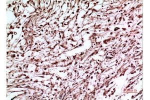 Immunohistochemistry (IHC) analysis of paraffin-embedded Human Brain, antibody was diluted at 1:100. (p53 anticorps  (Tyr216))