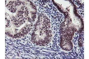 Image no. 4 for anti-Ankyrin Repeat Domain 53 (ANKRD53) (AA 1-300) antibody (ABIN1490719) (ANKRD53 anticorps  (AA 1-300))