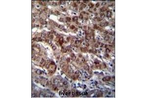 DARS Antibody (N-term) (ABIN655040 and ABIN2844671) immunohistochemistry analysis in formalin fixed and paraffin embedded human liver tissue followed by peroxidase conjugation of the secondary antibody and DAB staining.