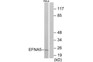 Western blot analysis of extracts from HeLa cells, using EFNA5 antibody. (Ephrin A5 anticorps  (Internal Region))