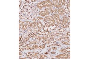 Immunohistochemical analysis of (ABIN391830 and ABIN2841673) on paraffin-embedded Human kidney tissue. (HSP70 1A anticorps  (AA 19-48))