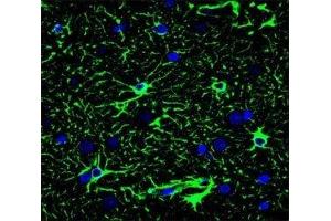 Confocal immunofluorescent analysis of GFAP antibody with brain tissue followed by Alexa Fluor 488-conjugated goat anti-mouse lgG (green). (GFAP anticorps)