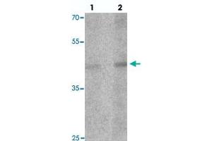Western blot analysis of LMX1A in rat brain tissue with LMX1A polyclonal antibody  at (1) 1 and (2) 2 ug/mL. (LMX1A anticorps  (C-Term))