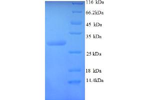 SDS-PAGE (SDS) image for Calcitonin-Related Polypeptide alpha (CALCA) (AA 83-118) protein (GST tag) (ABIN5712970)