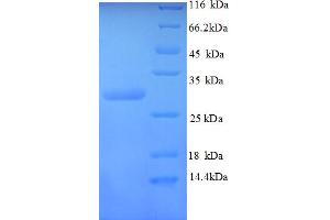 SDS-PAGE (SDS) image for Calcitonin-Related Polypeptide alpha (CALCA) (AA 83-118) protein (GST tag) (ABIN5712970)