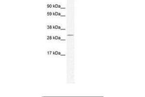 Image no. 1 for anti-Doublesex and Mab-3 Related Transcription Factor 2 (DMRT2) (AA 461-510) antibody (ABIN202258) (DMRT2 anticorps  (AA 461-510))