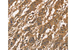 Immunohistochemistry (IHC) image for anti-Capping Protein (Actin Filament) Muscle Z-Line, alpha 3 (CAPZA3) antibody (ABIN2429679) (CAPZA3 anticorps)