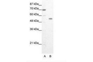 Image no. 1 for anti-Zinc Finger Protein 665 (ZNF665) (AA 76-125) antibody (ABIN202995) (ZNF665 anticorps  (AA 76-125))
