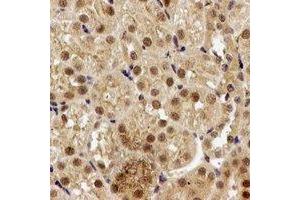 Immunohistochemical analysis of PPP2R2A staining in rat kidney formalin fixed paraffin embedded tissue section.