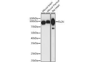 Western blot analysis of extracts of various cell lines, using FLCN antibody (ABIN7267226) at 1:1000 dilution. (FLCN anticorps  (AA 1-130))