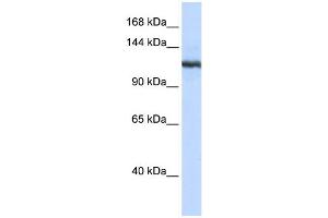 WB Suggested Anti-PLA2G4B Antibody Titration:  0. (PLA2G4B anticorps  (N-Term))