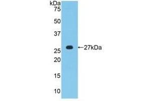 Detection of Recombinant MPZ, Human using Polyclonal Antibody to Protein Zero, Myelin (MPZ) (MPZ anticorps  (AA 30-248))
