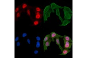 ABIN6256110 and ABIN6267388 staining Hela cells(30 min of UV treatment) by IF/ICC. (ATF2 anticorps  (pSer94, pSer112))