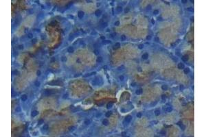 Detection of CTRC in Rat Pancreas Tissue using Polyclonal Antibody to Chymotrypsin C (CTRC) (Elastase 4 anticorps  (AA 30-268))