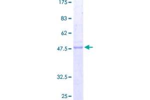 Image no. 1 for Prion Protein (PRNP) (AA 1-253) protein (GST tag) (ABIN1316351)