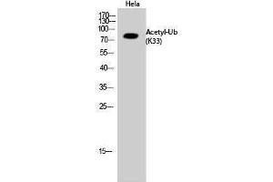 Western Blotting (WB) image for anti-Ubiquitin (Ubiquitin) (acLys33) antibody (ABIN3181498) (Ubiquitin anticorps  (acLys33))