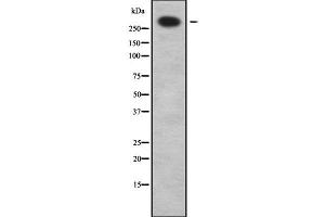 Western blot analysis of ABCA12 using LOVO whole cell lysates (ABCA12 anticorps  (C-Term))