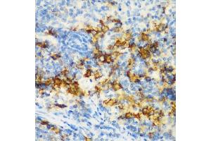 Immunohistochemistry of paraffin-embedded rat spleen using CD3D antibody (ABIN3021813, ABIN3021814, ABIN3021815 and ABIN6215992) at dilution of 1:200 (40x lens). (CD3D anticorps  (AA 22-105))