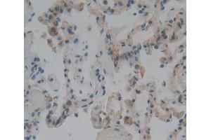 Used in DAB staining on fromalin fixed paraffin- embedded lung tissue (CENPJ anticorps  (AA 1-207))
