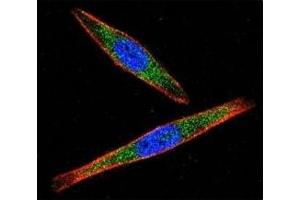 Confocal immunofluorescent analysis of LCK antibody with A2058 cells followed by Alexa Fluor 488-conjugated goat anti-rabbit lgG (green).