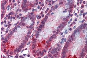 Human Small Intestine: Formalin-Fixed, Paraffin-Embedded (FFPE)