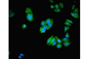 Immunofluorescent analysis of HepG2 cells using ABIN7141994 at dilution of 1:100 and Alexa Fluor 488-congugated AffiniPure Goat Anti-Rabbit IgG(H+L) (MICAL2 anticorps  (AA 1-495))