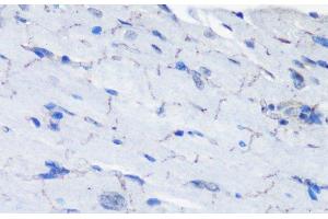 Immunohistochemistry of paraffin-embedded Mouse heart using Phospho-P70 S6K(T389) Polyclonal Antibody at dilution of 1:100 (40x lens).