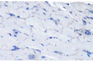 Immunohistochemistry of paraffin-embedded Mouse heart using Phospho-P70 S6K(T389) Polyclonal Antibody at dilution of 1:100 (40x lens). (RPS6KB1 anticorps  (pThr389))