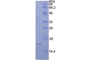 SDS-PAGE analysis of Human Laminin alpha 1 Protein. (Laminin alpha 1 Protéine)