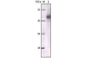 Western blot analysis using CK mouse mAb against truncated CK5 recombinant protein. (Cytokeratin 1 anticorps)