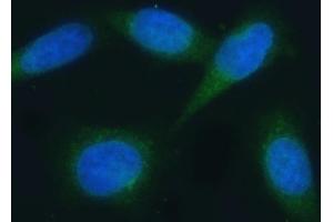 IF analysis of VAPA using anti-VAPA antibody (ABIN7603249). (VAPA anticorps  (N-Term))