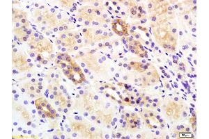 Formalin-fixed and paraffin embedded rat kidney labeled with Rabbit Anti Insulin Receptor Beta Polyclonal Antibody, Unconjugated (ABIN727340) at 1:200 followed by conjugation to the secondary antibody and DAB staining (ISR-beta anticorps  (AA 1001-1100))