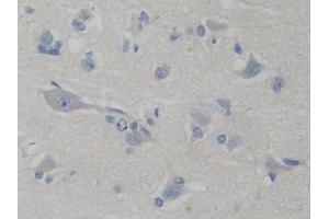 Detection of PFKP in Human Brain Tissue using Polyclonal Antibody to Phosphofructokinase, Platelet (PFKP)