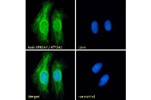 (ABIN1686784) mmunofluorescence analysis of paraformaldehyde fixed HeLa cells, permeabilized with 0. (ATP2A2 anticorps  (Internal Region))