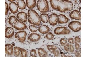 Image no. 2 for anti-P21-Activated Kinase 1 (PAK1) (AA 191-280) antibody (ABIN598852) (PAK1 anticorps  (AA 191-280))